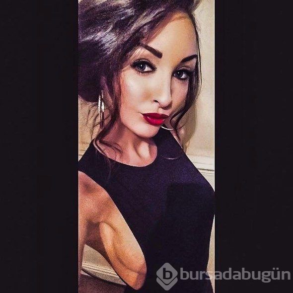 Eğlenmeye gittiği striptiz kulübünde kafasına tüp düştü!