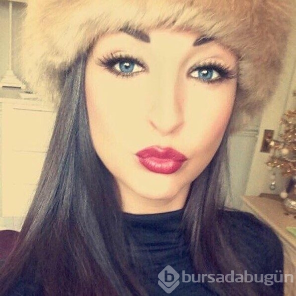 Eğlenmeye gittiği striptiz kulübünde kafasına tüp düştü!