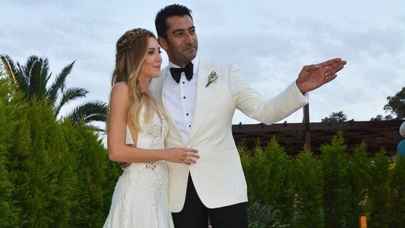 Sinem Kobal'ın yüzüne ne oldu?