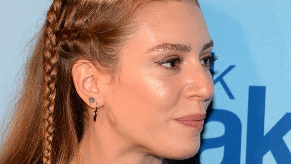 Sinem Kobal'ın yüzüne ne oldu?
