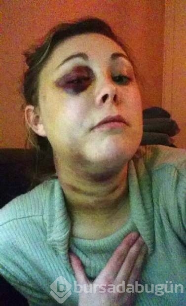 Cinsel ilişki teklifini reddetti öldüresiye dövüldü