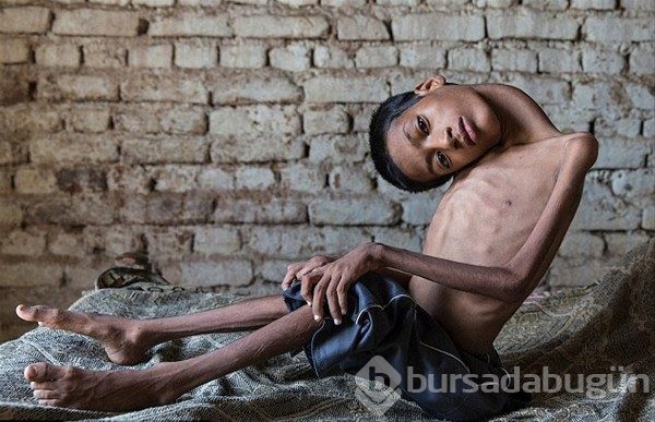 12 yıldır başını kaldıramıyordu! Bir de şimdi görün
