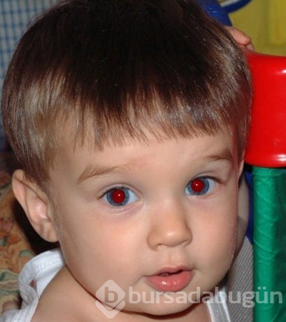Fotoğraflarda kırmızı gözlü çıkmamak için ne yapabiliriz?
