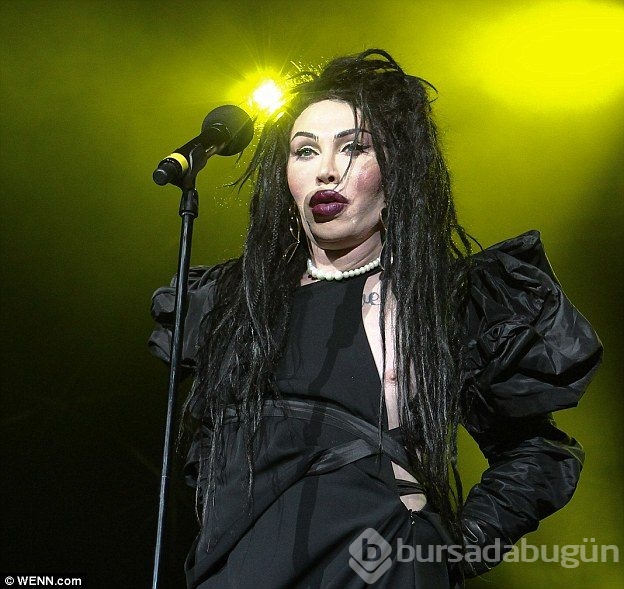 Ünlü şarkıcı Pete Burns yaşamını yitirdi