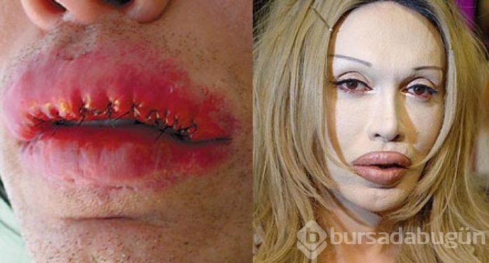Ünlü şarkıcı Pete Burns yaşamını yitirdi
