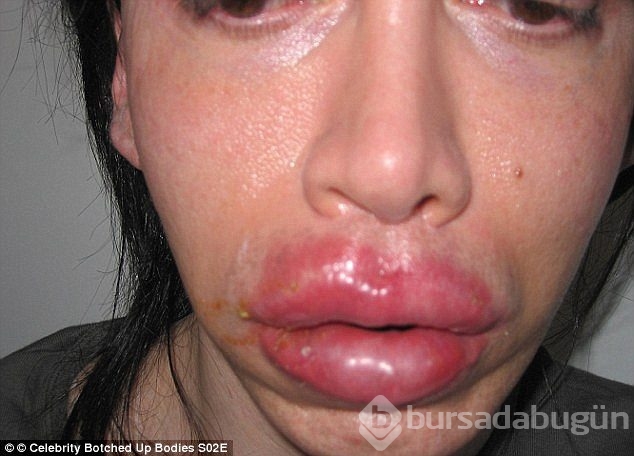 Ünlü şarkıcı Pete Burns yaşamını yitirdi