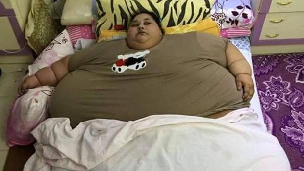 500 kilo 25 yıldır evden dışarı çıkmadı