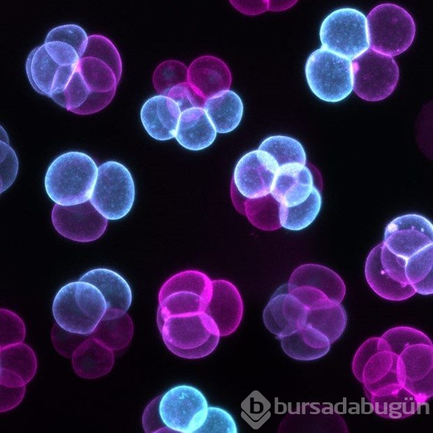 Mikroskobin dünyaya bir de bu gözle bakın