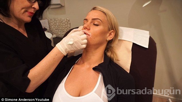 90 kilo verdi şimdi de estetik yaptırıyor
