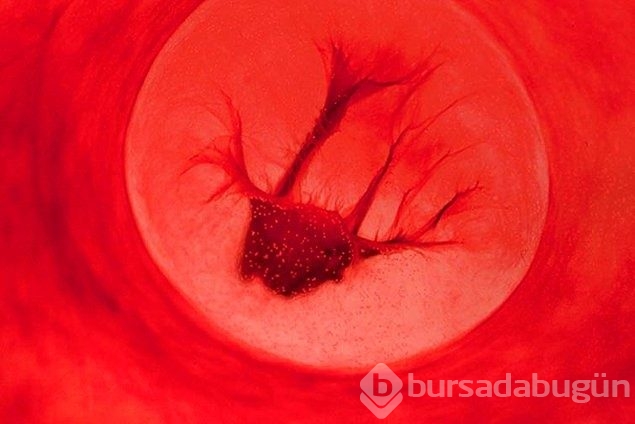 Regl kanıyla fotoğraf yaptı sanat eseri dedi!
