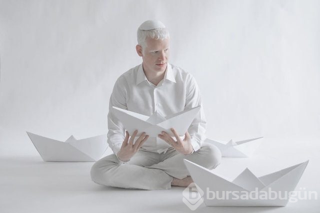 Albinoların eşsiz güzelliği 