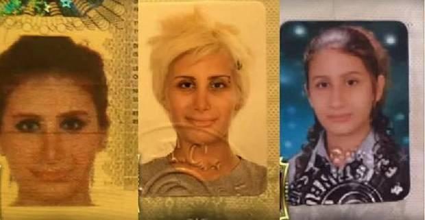 Ünlülerin estetiksiz halleri şaşırttı!