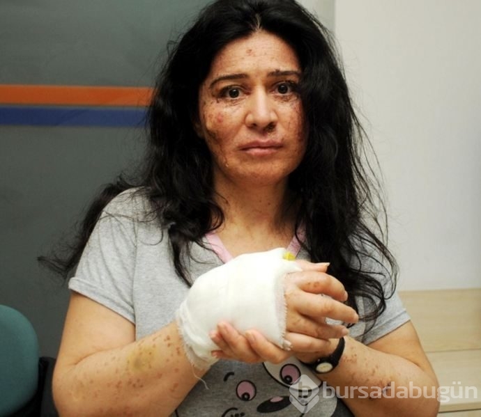 Hastalığı dünyada sadece 250 kişide var