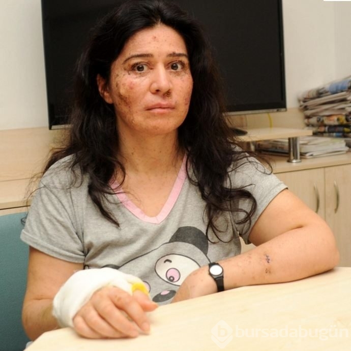 Hastalığı dünyada sadece 250 kişide var