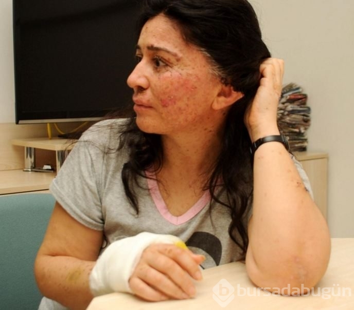 Hastalığı dünyada sadece 250 kişide var