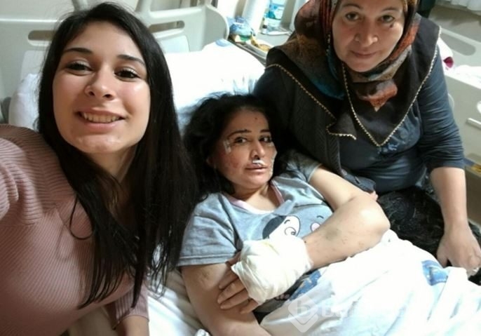 Hastalığı dünyada sadece 250 kişide var