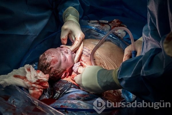 2016'nın en duygusal doğum fotoğrafları