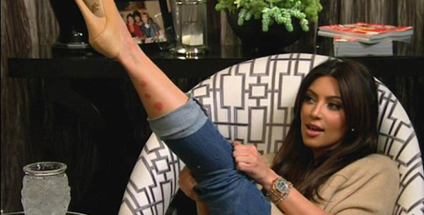 Kim Kardashian'ın hastalığı yüzüne sıçradı