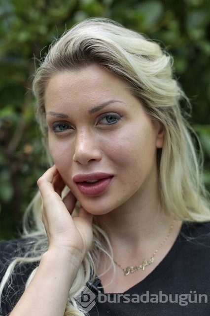 Pixee Fox barbie bebek ameliyatı için İstanbul'a geldi