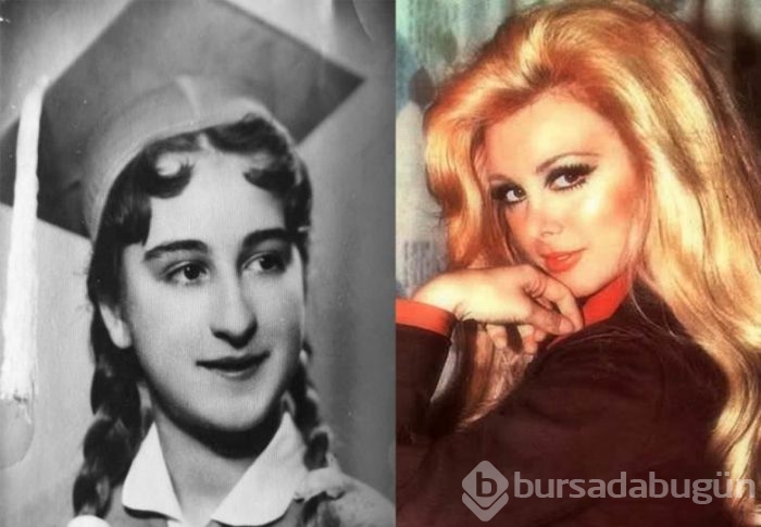 Estetik mucizesine inandıran en güzel ünlüler