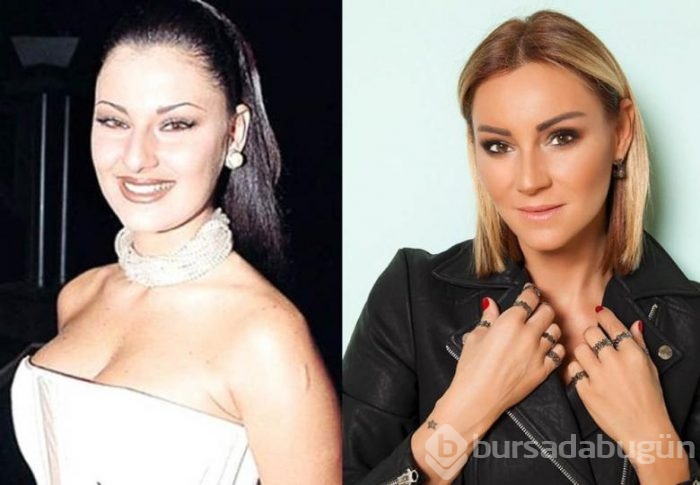 Estetik mucizesine inandıran en güzel ünlüler