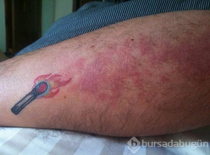 Doğum lekesini müthiş dövmelerle kapatan 29 kişi