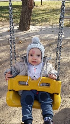 Alnında kalp şeklinde doğum lekesi var!