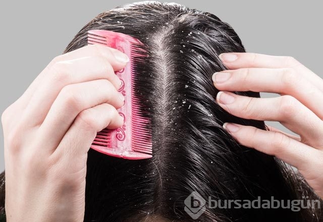 Şampuan yerine sirke kullanın