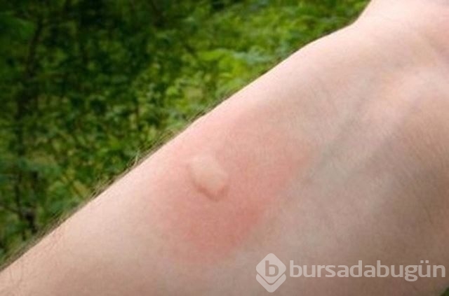 Evde, işte sizi kurtaracak pratik bilgiler!