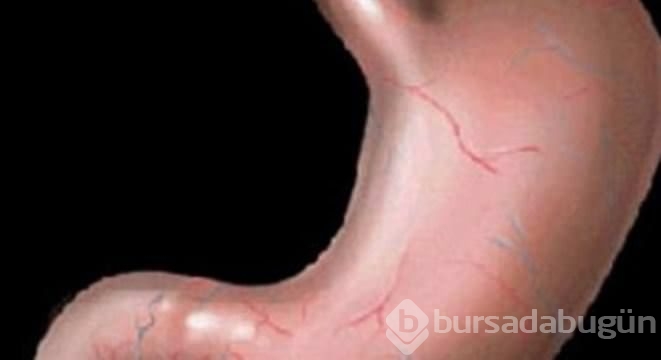Enteresan sorular ve cevapları