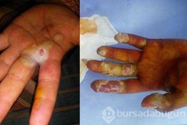 Nükleer 'tespih' hayatını kararttı!