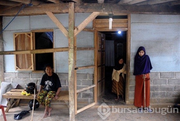 Dünyanın en tuhaf hastalıkları