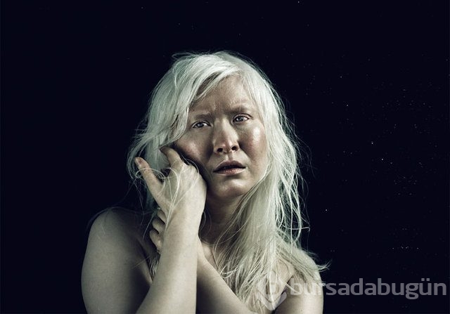 Albinoların eşsiz güzellikleri fotoğraflara yansıdı