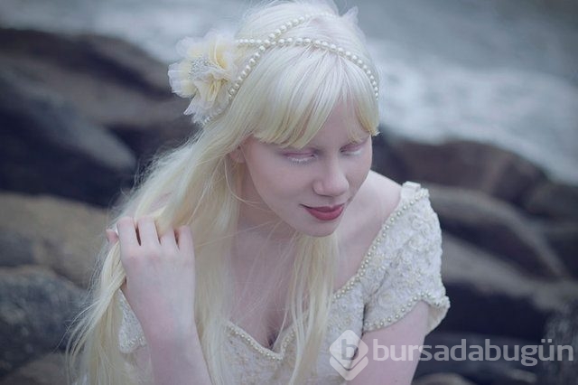 Albinoların eşsiz güzellikleri fotoğraflara yansıdı