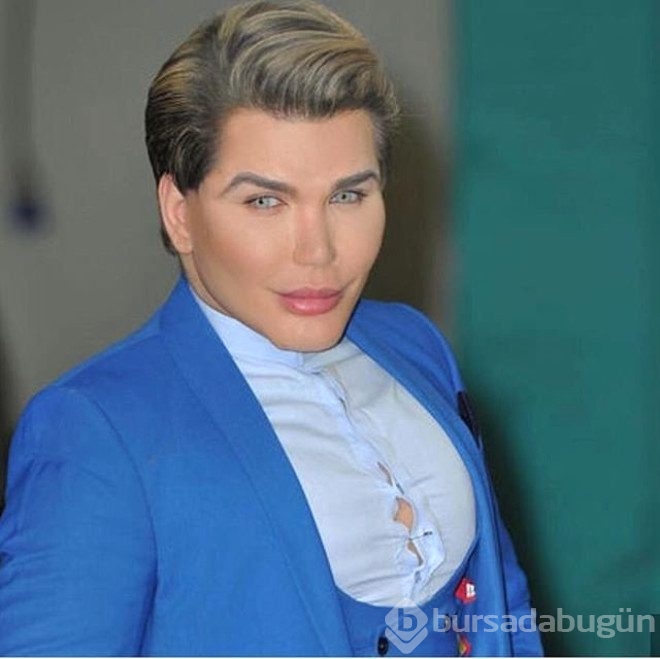 Bir kez daha estetik olursa burnu düşecek