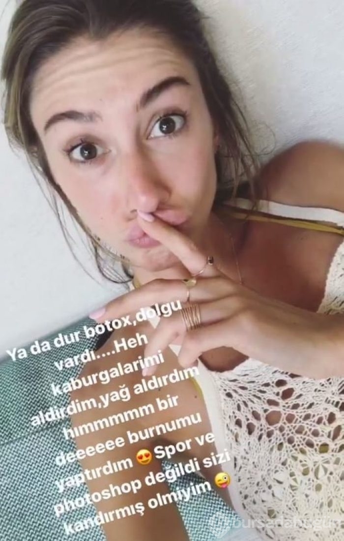 Şeyma Subaşı ''Her yerimi yaptırdım''