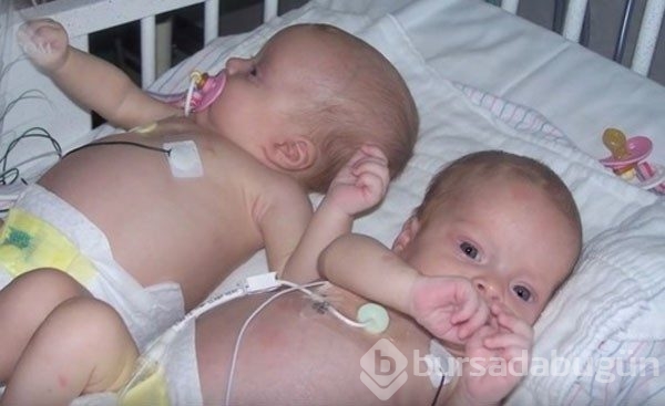 Doktor bebeğin karnındaki şişliği fark etti ve şoke oldu