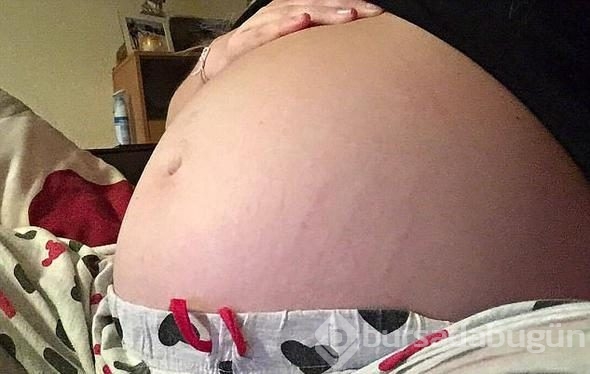 Herkes 7 aylık hamile sanıyordu! Doktor şoke eden gerçeği açıkladı
