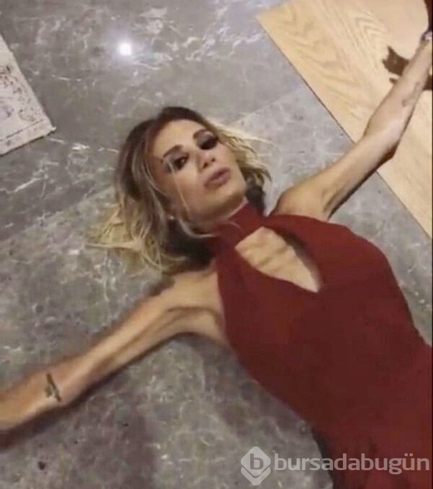 İrem Derici'nin hastalığı...