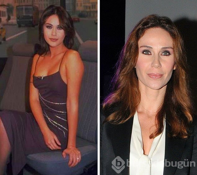 Estetik yapan ünlüler