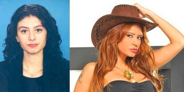 Estetik yapan ünlüler
