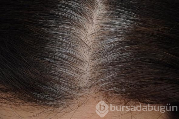 Vücudunuzda yaşananlar bir eksiklikten olabilir