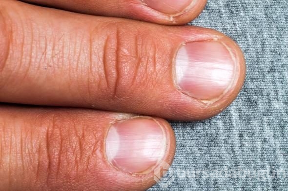 Vücudunuzda yaşananlar bir eksiklikten olabilir