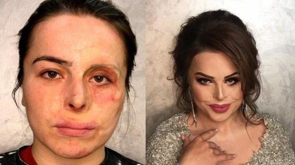 Kaza geçirmiş insanları makyajla yeniden yaratıyor!