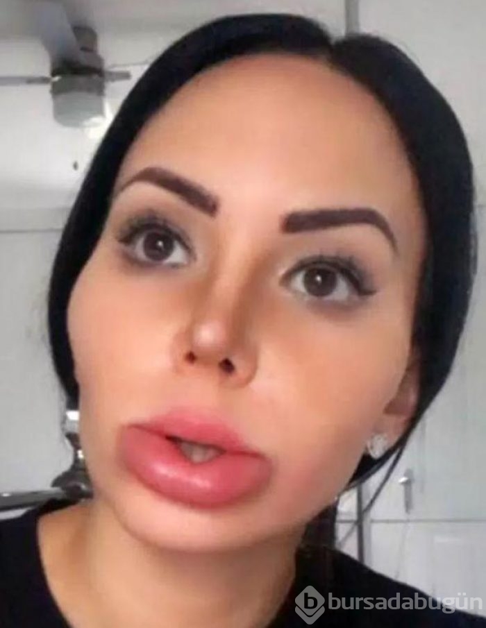 Eski hali böyleydi: 'Bana çirkin dediler'