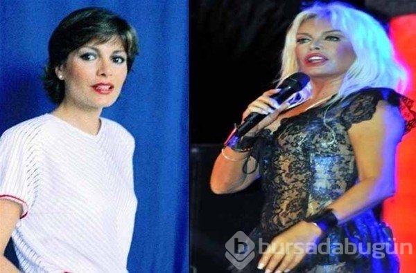 Ünlülerin estetiksiz halleri