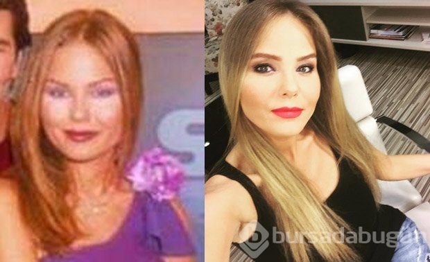 Ünlüler böyle değişti