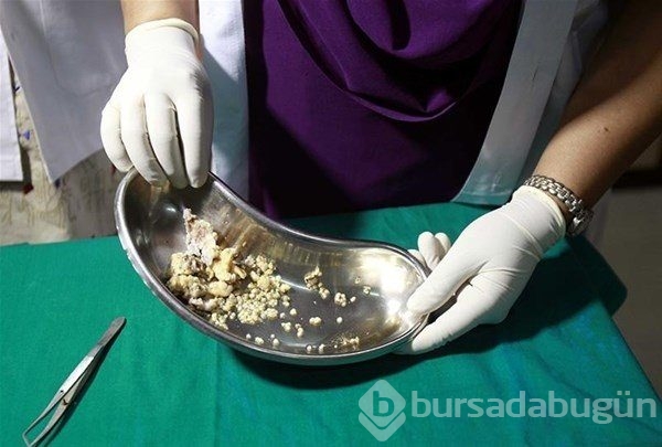 Dünyanın en tuhaf hastalıkları