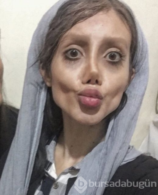 Angelina Jolie'ye benzemek için servet harcadı
