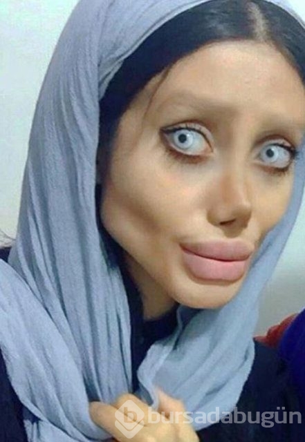 Angelina Jolie'ye benzemek için servet harcadı
